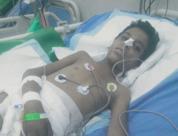 وسط صرخات التباكي على أطفال غزة.. جريمة قنص حوثية جديدة تقضي على براءة طفل بلحج