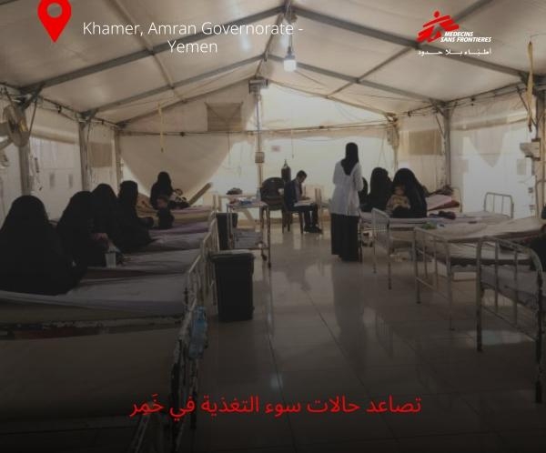 زيادة حالات سوء التغذية الحاد لدى الأطفال في عمران بنسبة 48%