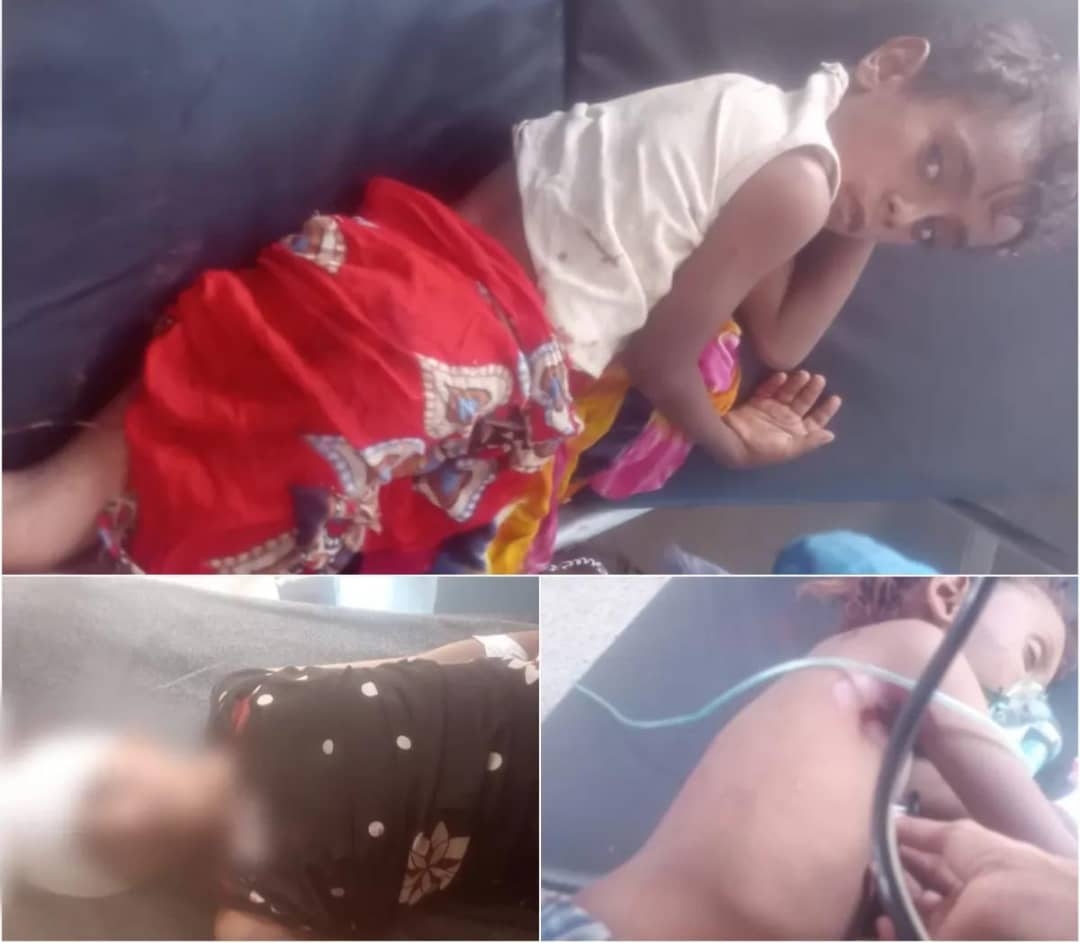 أكثر من 7 مدنيين بين شهيد وجريح معظمهم أطفال بقصف مليشيا الحوثي على قرى في ريف حيس جنوب الحديده